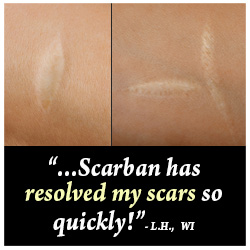 Scar-Ban Scar Lotion Customer Testimonial